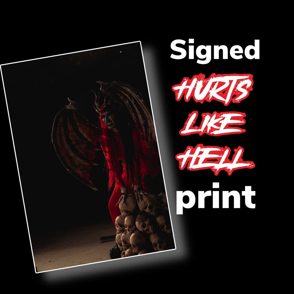 Image of Singed Hurts Like Hell Print 