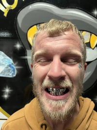 Image 4 of Silver per tooth 