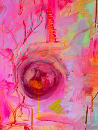 Image 2 of Urostomy | Original Painting 