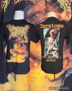 Image of Officially Licensed Viscera Infest “Teratoma” Shirts! 