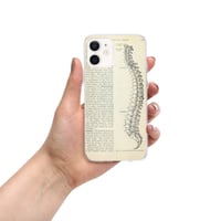 Image 16 of Vintage Book Page Anatomical Illustration Human Spine Clear Case for iPhone®