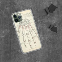 Image 4 of Antique Bookpage Detailed Anatomical Illustration Human Hand Clear Case for iPhone®