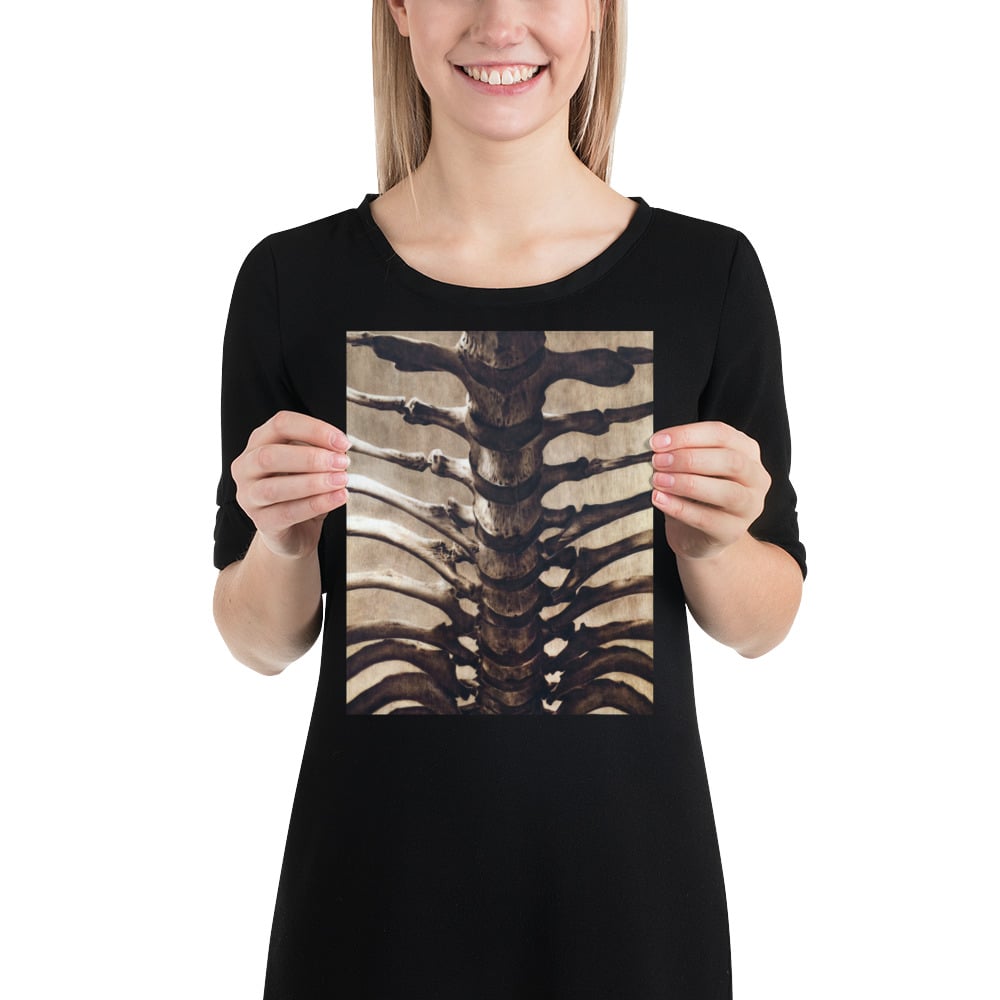 Photo Print: Human Spine and Ribcage