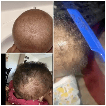 Image of Sabr’s Small hair growth