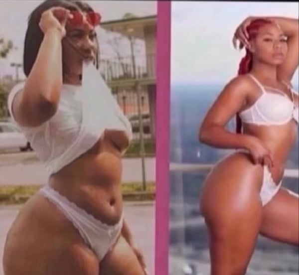 Image of Fat burner lipo shots