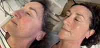 Image 3 of PRESCRIPTA SKIN collagen facial contouring 