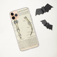 Image 3 of Antique Bookpage Detailed Anatomical Illustration Finger Bones Clear Case for iPhone®