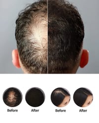 Image 4 of Hair Fiber Kit 