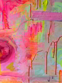 Image 5 of Urostomy | Original Painting 