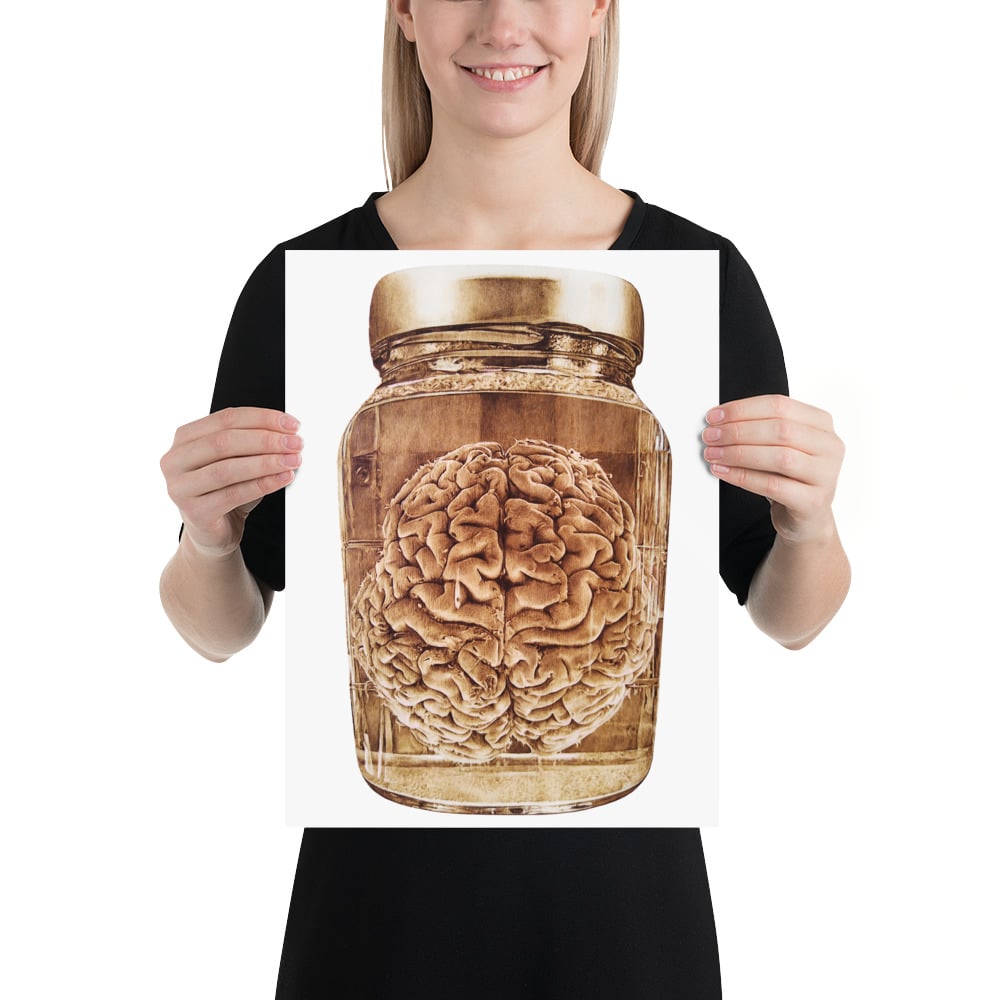 Photo Print: Brain Wet Specimen (white)