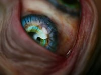 Image 10 of Custom Swappable Phone Grip for smartphones, glow in the dark double iris, reflective pupil