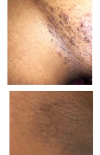 Image 3 of SMOOTH SKIN ELIXIR  Clears ingrown hairs + Razor bumps 