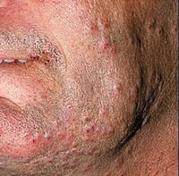 Image 5 of "DERMA" COMFREY & ARNICA HEALING SALVE 