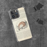 Image 1 of Antique Bookpage Detailed Anatomical Illustration Human Skull Clear Case for iPhone®