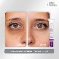 Image 4 of LUXE ORGANIX ADVANCED RETINOL + BUKUCHIOL DEEP WRINKLE EYE CONTOUR CREAM 12G