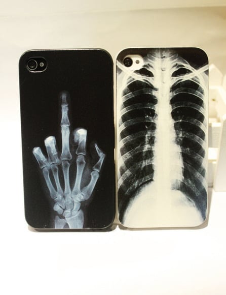Image of X-ray Skull Bone Cover Case Iphone 4/4s/5