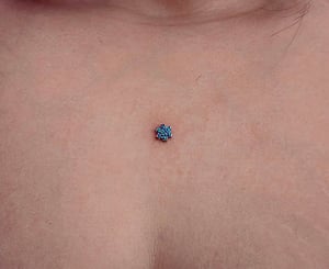 MICRODERMAL PIERCING SERVICES