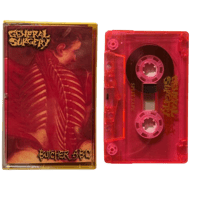 Image 1 of GENERAL SURGERY / BUTCHER ABC - split cassette