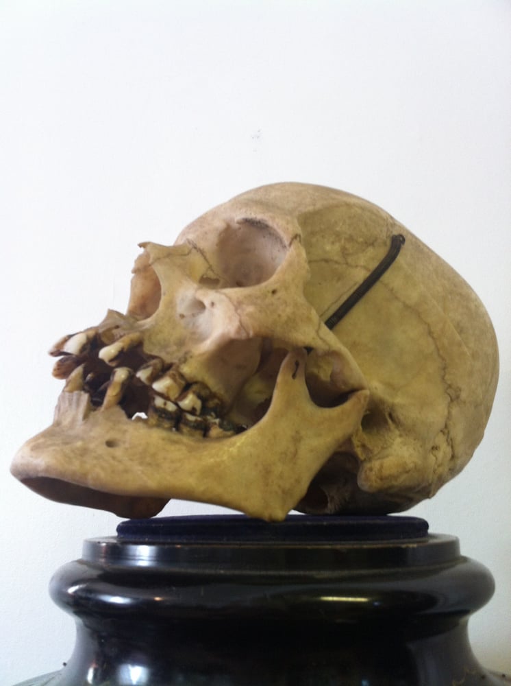 Image of antique unique human skull