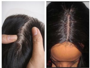 Image of Dream Hair Lace Closures