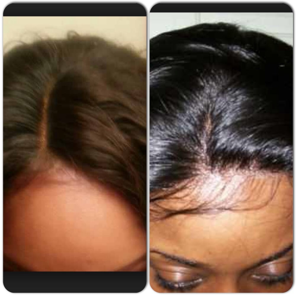 Image of 100% VIRGIN 7A LACE FRONTAL CLOSURE