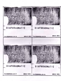 14 Diaphragmatic