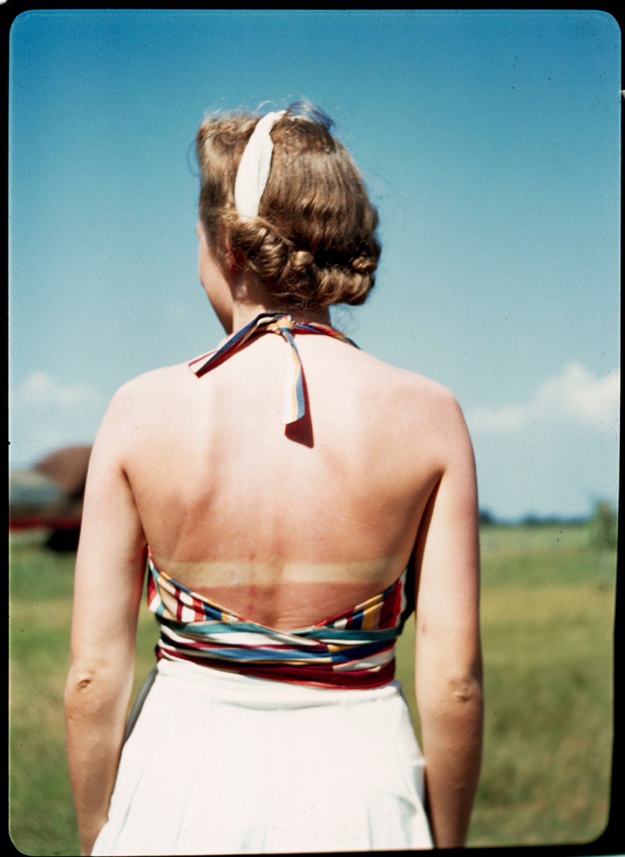 Image of 1940's gal on a farm gets a sunburn