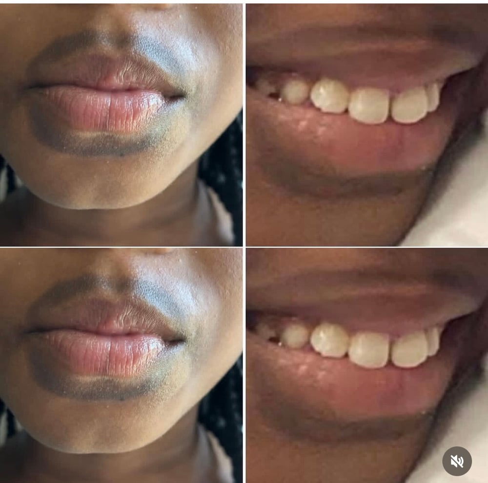 Image of Turmeric CoCoa Butter  & Healing Aid Oil Kit