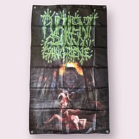 Image 2 of Purulent Granny Gangrene 