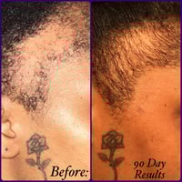 Image 3 of ROSE HAIR OIL (Growth Drops) 