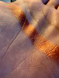 Image 5 of Acid Burn