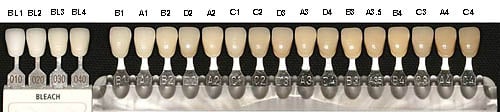 Image of Teeth Whitening Kit