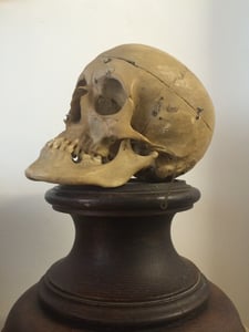 Image of antique disarticulated very rare human skull