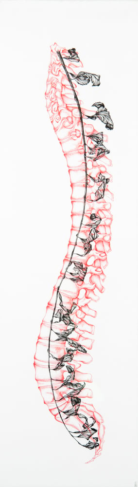 Image of Lateral View of the Spine