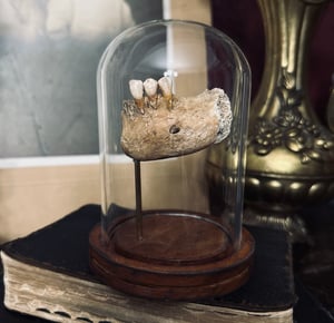 Image of Human Mandibular Symphisis