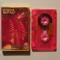 Image 2 of GENERAL SURGERY / BUTCHER ABC - split cassette