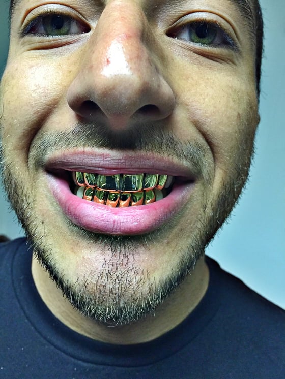 Image of 10k Yellow Gold Grill