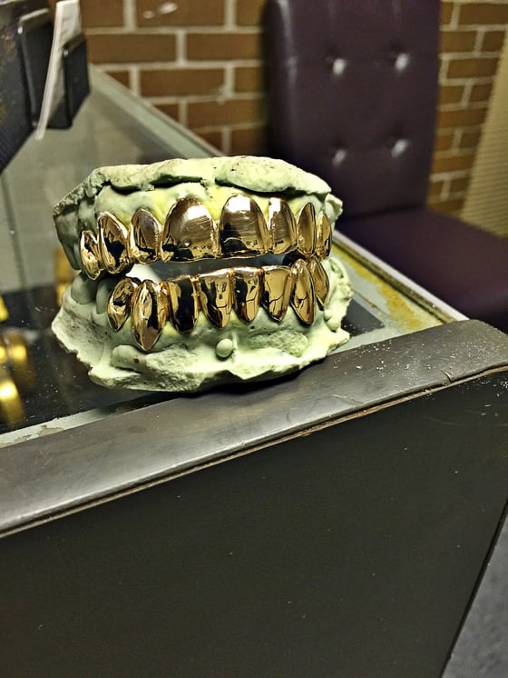 Image of 18k Gold Grill