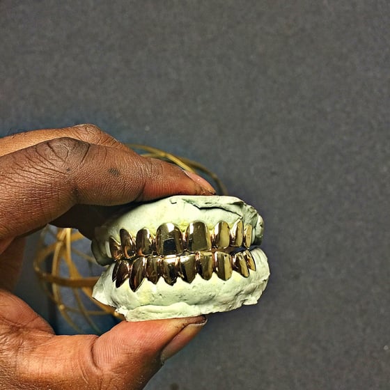 Image of 14k Gold Grill