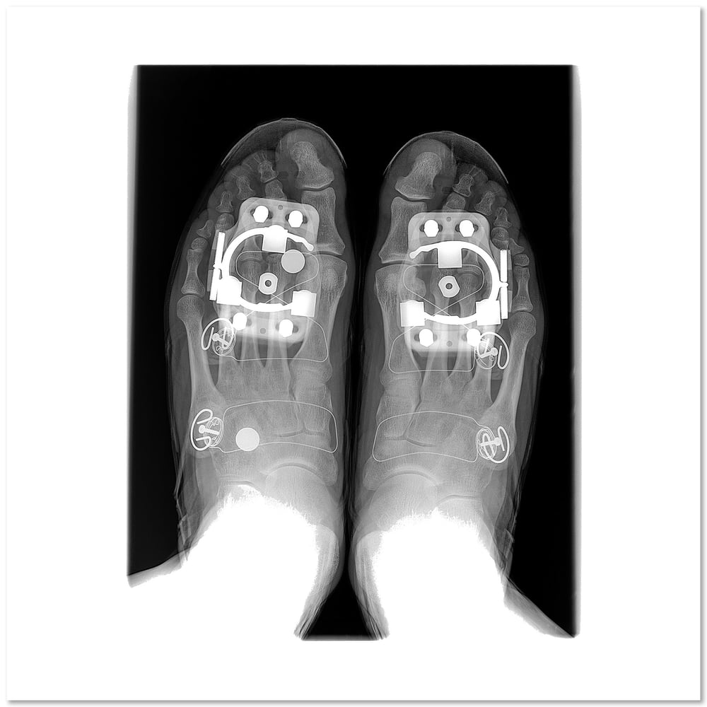 Image of Feet in Cycling Shoes
