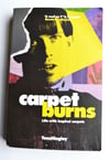 Signed Copy of Carpet Burns - Tom Hingley's Inspiral Carpets Memoir