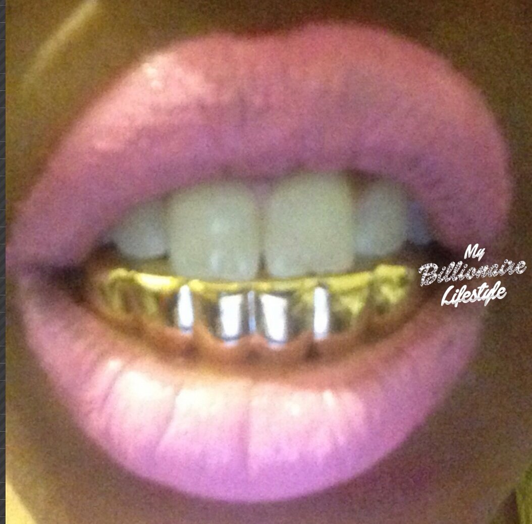 My Billionaire Lifestyle — GRILLZ