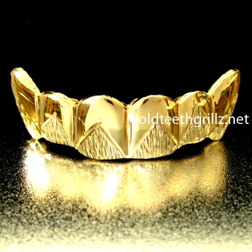 Image of Custom Gold Grillz for 4