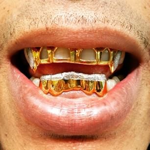 Image of Custom Gold Grillz for 8