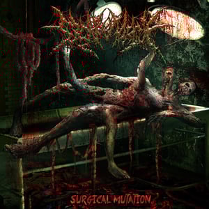 Image of SICK MORGUE - SURGICAL MUTATION CD/SNAP BACK CAPS
