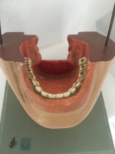 Image of antique vintage dresden museum mouth and neck medical moulage