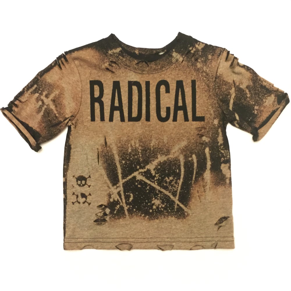 Radical