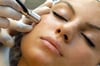 Microdermabrasion Diamond Tip