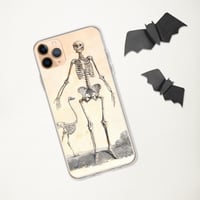 Image 3 of Antique Bookpage Detailed Anatomical Illustration Human and Bird Skeletons Clear Case for iPhone®