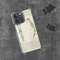 Image 1 of Antique Bookpage Detailed Anatomical Illustration Finger Bones Clear Case for iPhone®